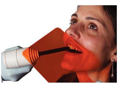 Cure-Shield Handheld Visible Curing Light Shield, Orange, 3/Pk, 9006166 thumbnail 7