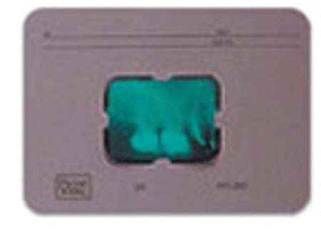 Greylight X-Ray Mounts 100/Pk 18-6V thumbnail 2