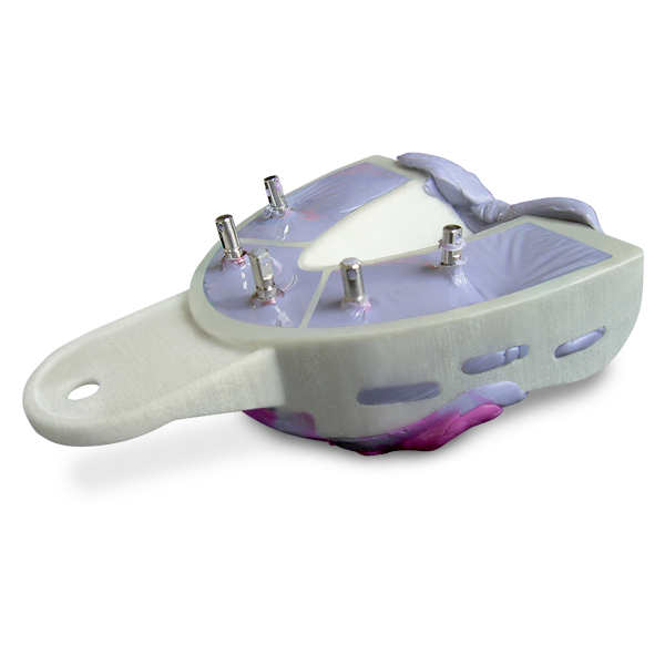 Miratray Implant Advanced Impression Trays, Intro Kit, 6/Pk product image