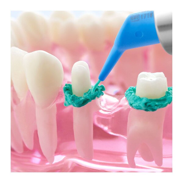 Dryz Blu Retraction Paste Intro Kit Unit Dose 30/Caps DC Dental