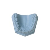 Resinrock Blue 33lb/15kg