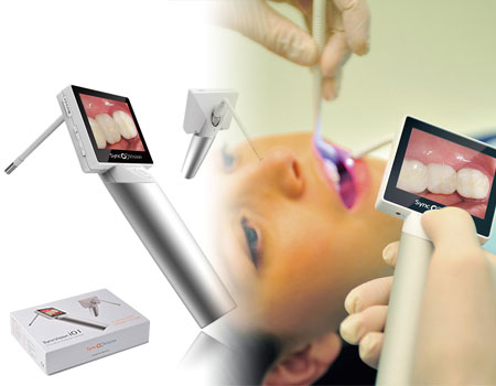 SyncVision iO1 Intraoral Camera Smart Pk image