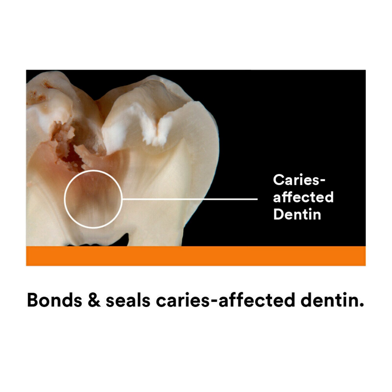 Scotchbond Universal Plus Unit Dose 200/Pk thumbnail 13