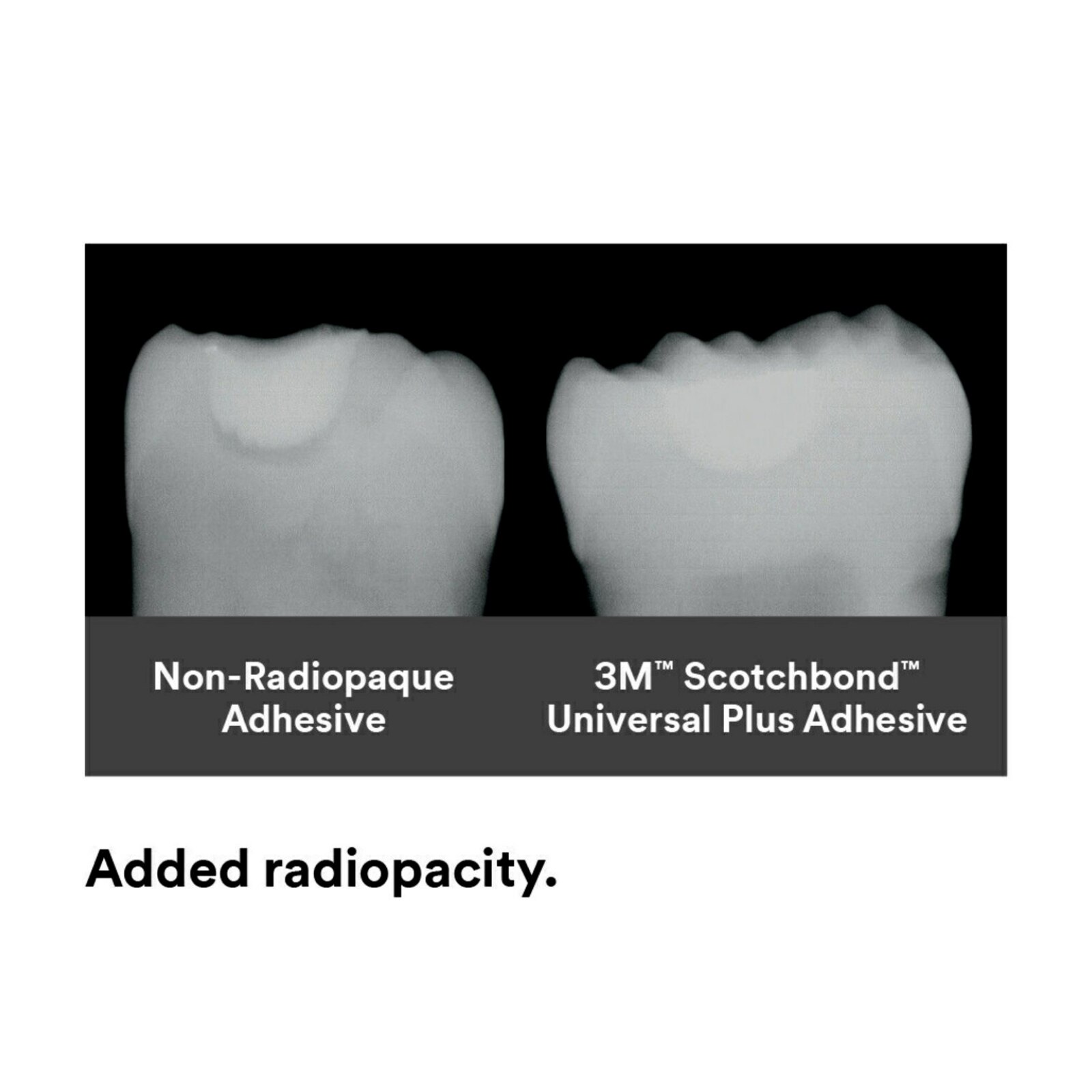 Scotchbond Universal Plus Unit Dose 100/Pk thumbnail 11