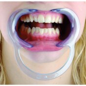 Spandex Lip Retractor Child 2/Pk