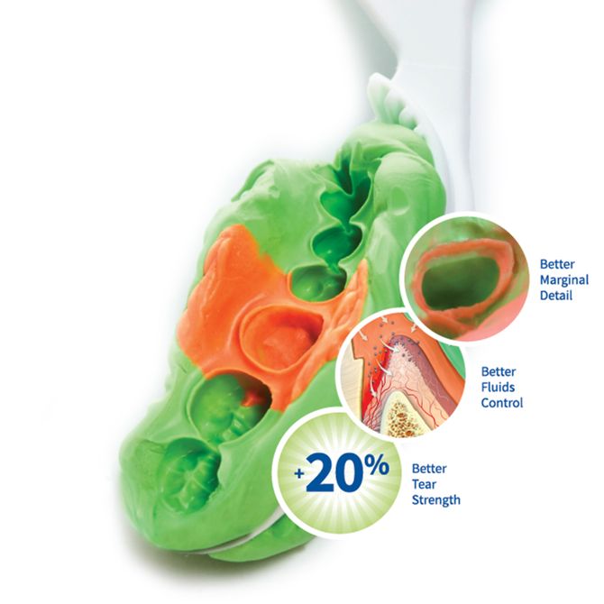 NoCord VPS One-Step Self-Retracting Impressioning System, Bulk Refill Kit, 1/Pk, 310285 thumbnail 6
