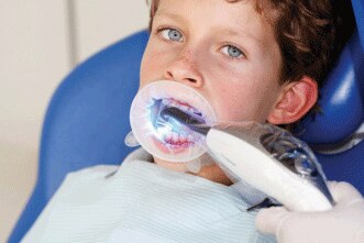 OptraGate 3D Retractor Junior 80/Bx, 591451 - OptraGate 3D Retractor Junior 80/Bx, 591451 - Image 1