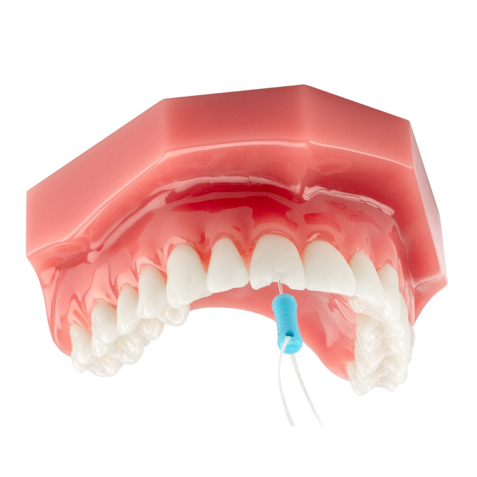 DentXpin Intro Kit 10/Pk thumbnail 4