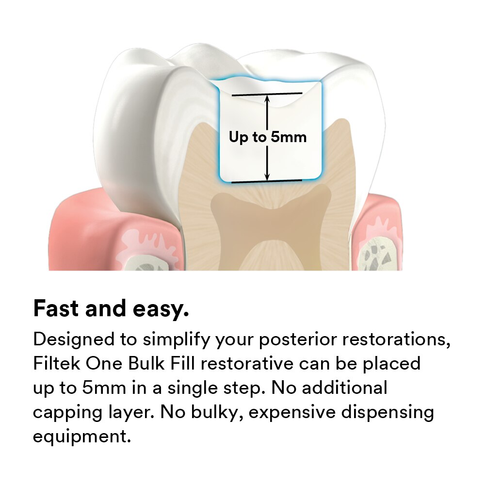 Filtek One Bulk Fill, Syringe Refill, 4 g, A1, 1/Pk, 4866A1 thumbnail 10